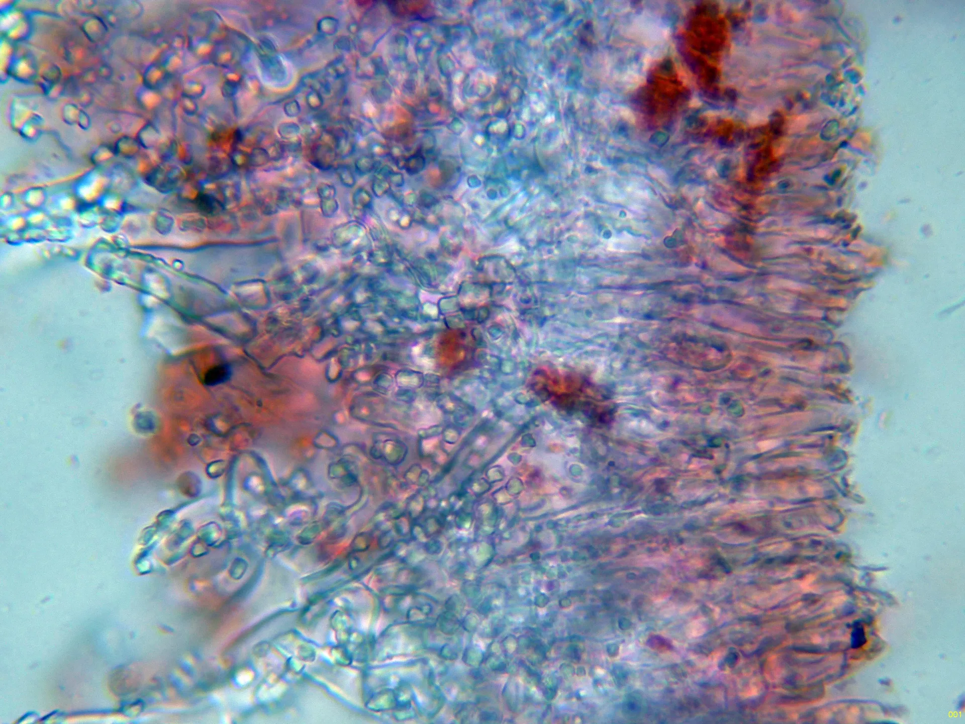 Microscopía de Phanerochaete sordida - 10 - Sección himenio-001